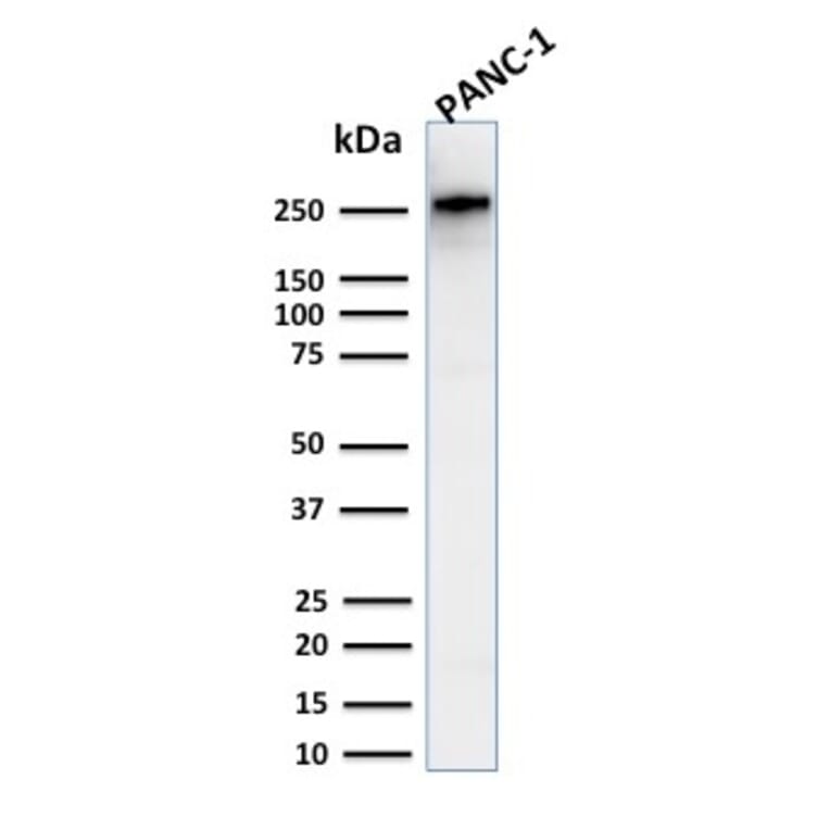 Western Blot - Anti-beta III Spectrin Antibody [SPTBN2/2894R] (A250049) - Antibodies.com