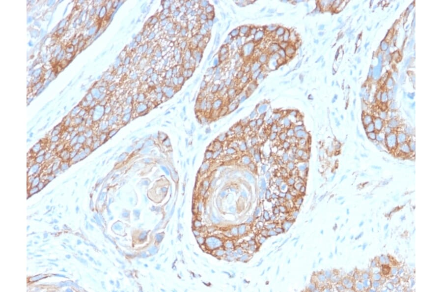 Immunohistochemistry - Anti-beta III Spectrin Antibody [SPTBN2/2979R] (A250050) - Antibodies.com