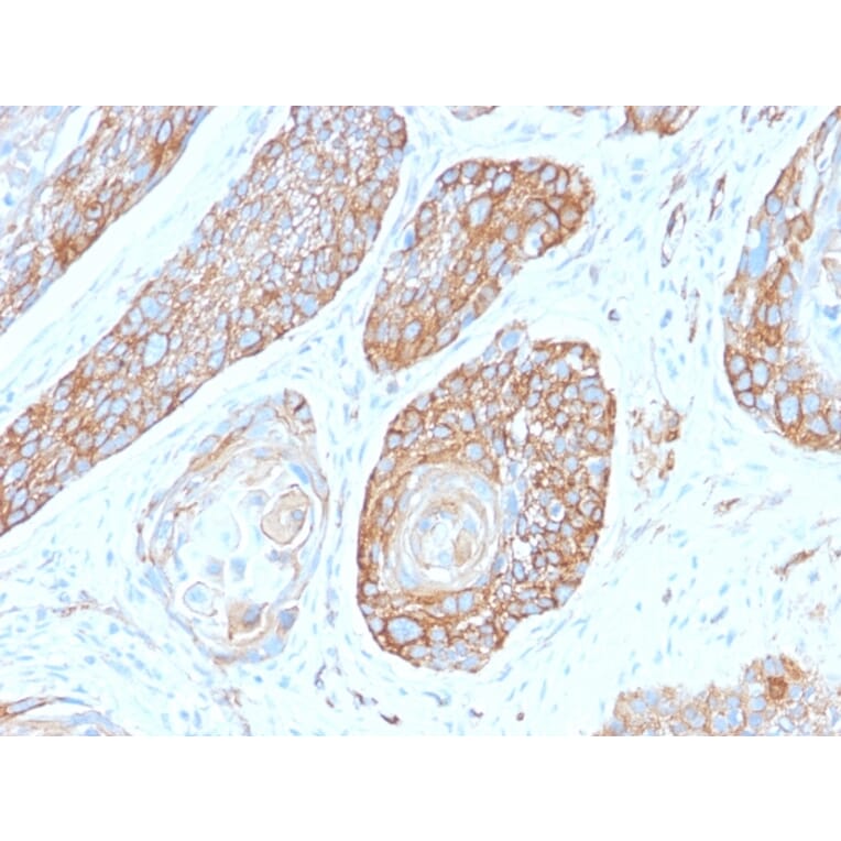 Immunohistochemistry - Anti-beta III Spectrin Antibody [SPTBN2/2979R] (A250050) - Antibodies.com