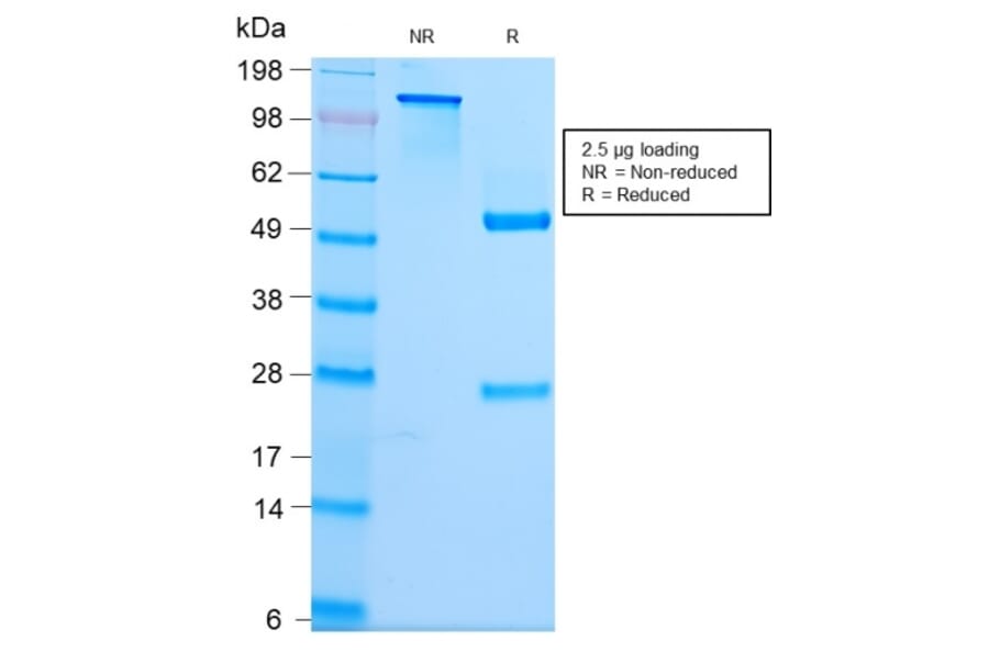 SDS-PAGE - Anti-beta III Spectrin Antibody [SPTBN2/2979R] (A253229) - Antibodies.com
