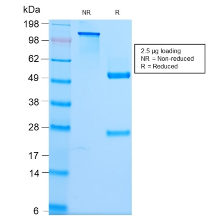 SDS-PAGE - Anti-beta III Spectrin Antibody [SPTBN2/2979R] (A250050) - Antibodies.com