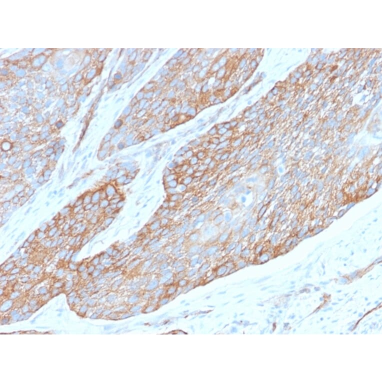 Immunohistochemistry - Anti-beta III Spectrin Antibody [SPTBN2/2979R] (A250049) - Antibodies.com