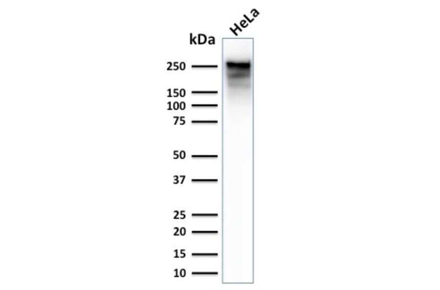 Western Blot - Anti-beta III Spectrin Antibody [SPTBN2/2979R] (A253225) - Antibodies.com