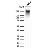 Western Blot - Anti-beta III Spectrin Antibody [SPTBN2/2979R] (A250050) - Antibodies.com