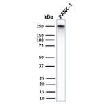 Western Blot - Anti-beta III Spectrin Antibody [SPTBN2/2979R] (A250050) - Antibodies.com