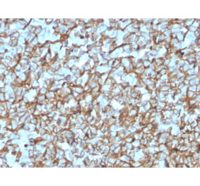 Immunohistochemistry - Anti-beta III Spectrin Antibody [SPTBN2/3142R] (A250051) - Antibodies.com
