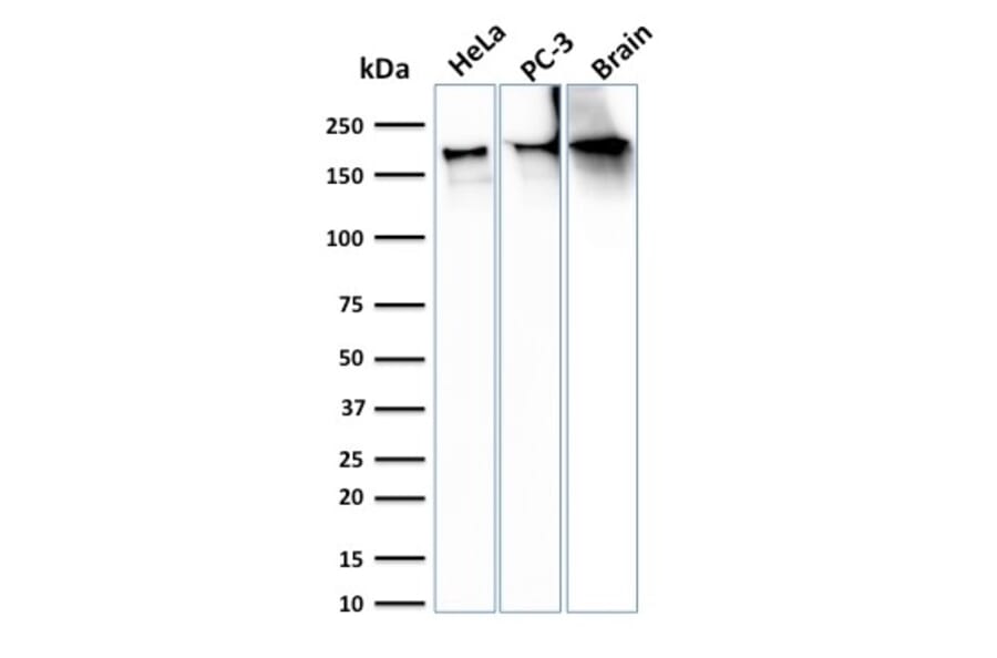 Western Blot - Anti-beta III Spectrin Antibody [SPTBN2/3142R] (A250051) - Antibodies.com