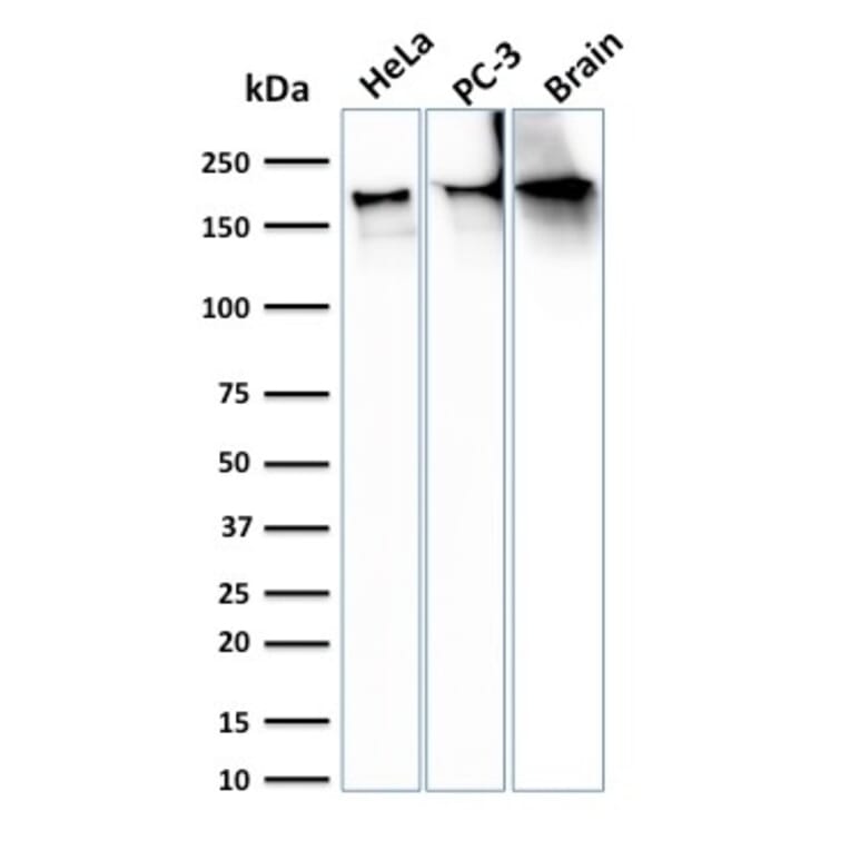 Western Blot - Anti-beta III Spectrin Antibody [SPTBN2/3142R] (A250051) - Antibodies.com