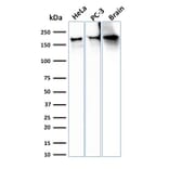 Western Blot - Anti-beta III Spectrin Antibody [SPTBN2/3142R] (A250051) - Antibodies.com