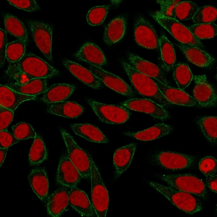 Immunofluorescence - Anti-beta III Spectrin Antibody [SPTBN2/3142R] (A250051) - Antibodies.com