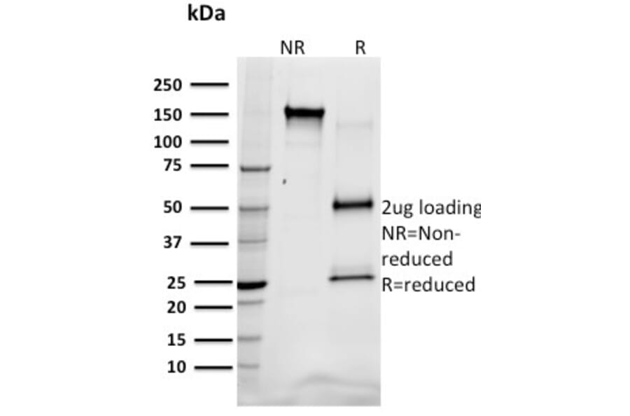 SDS-PAGE - Anti-SREBP1 Antibody [SREBP1/1578] (A250051) - Antibodies.com