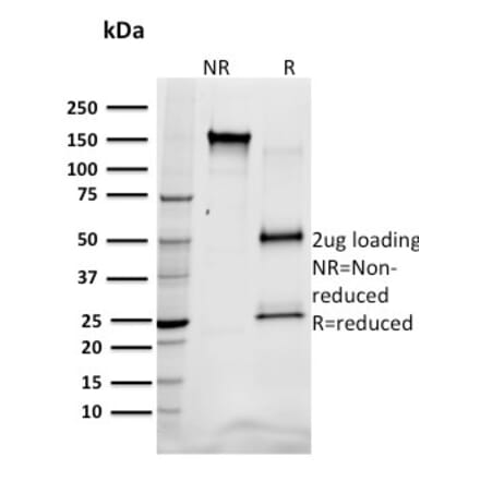 SDS-PAGE - Anti-SREBP1 Antibody [SREBP1/1578] (A250051) - Antibodies.com