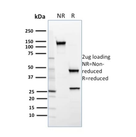 SDS-PAGE - Anti-SREBP2 Antibody [SREBP2/1579] (A250052) - Antibodies.com