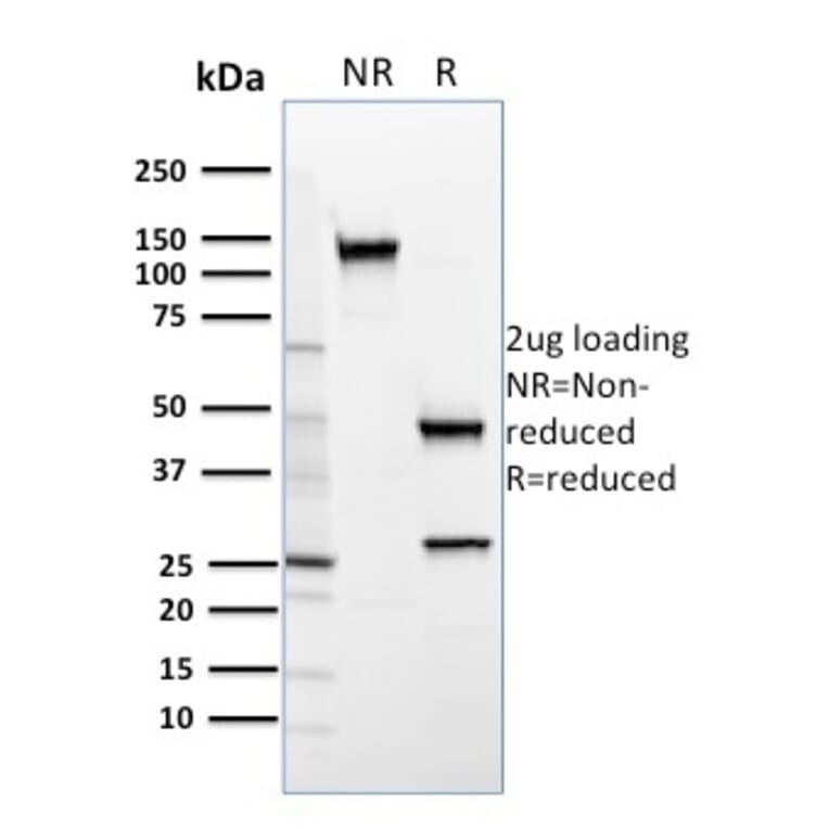 SDS-PAGE - Anti-SREBP2 Antibody [SREBP2/1579] (A250052) - Antibodies.com