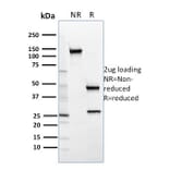 SDS-PAGE - Anti-SREBP2 Antibody [SREBP2/1579] (A250052) - Antibodies.com