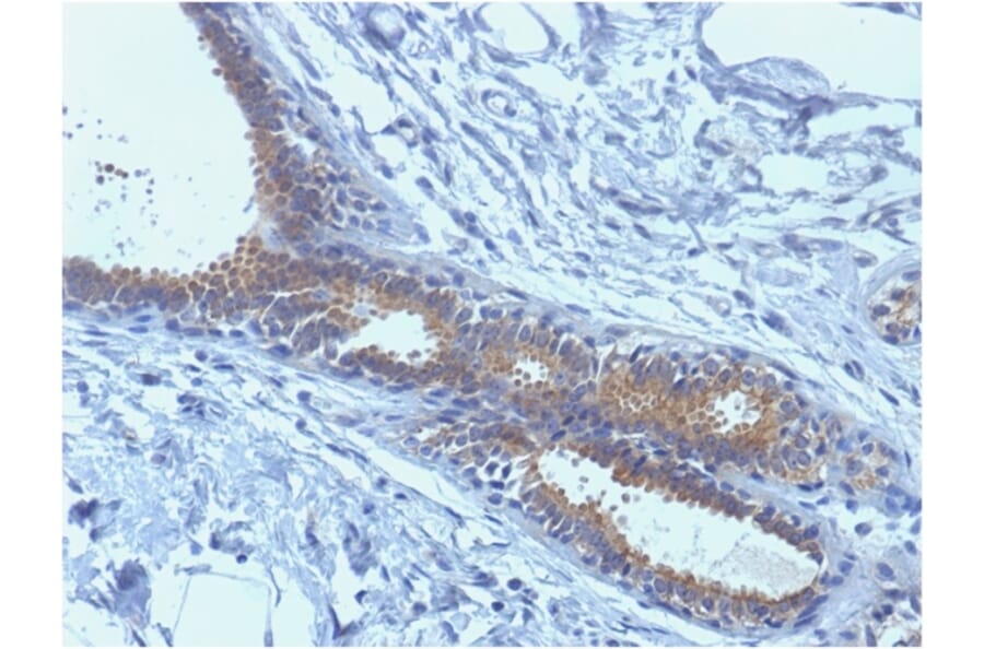 Immunohistochemistry - Anti-BRCA1 Antibody [BRCA1/1398] (A250054) - Antibodies.com