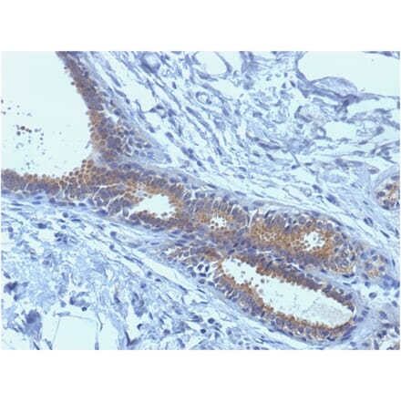 Immunohistochemistry - Anti-BRCA1 Antibody [BRCA1/1398] (A250054) - Antibodies.com
