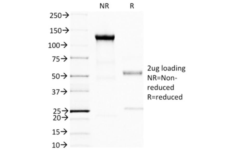 SDS-PAGE - Anti-BRCA1 Antibody [BRCA1/1398] (A250054) - Antibodies.com