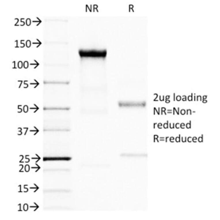 SDS-PAGE - Anti-BRCA1 Antibody [BRCA1/1398] (A250054) - Antibodies.com