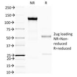 SDS-PAGE - Anti-BRCA1 Antibody [BRCA1/1398] (A250054) - Antibodies.com