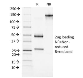 SDS-PAGE - Anti-BRCA1 Antibody [BRCA1/1472] (A253234) - Antibodies.com
