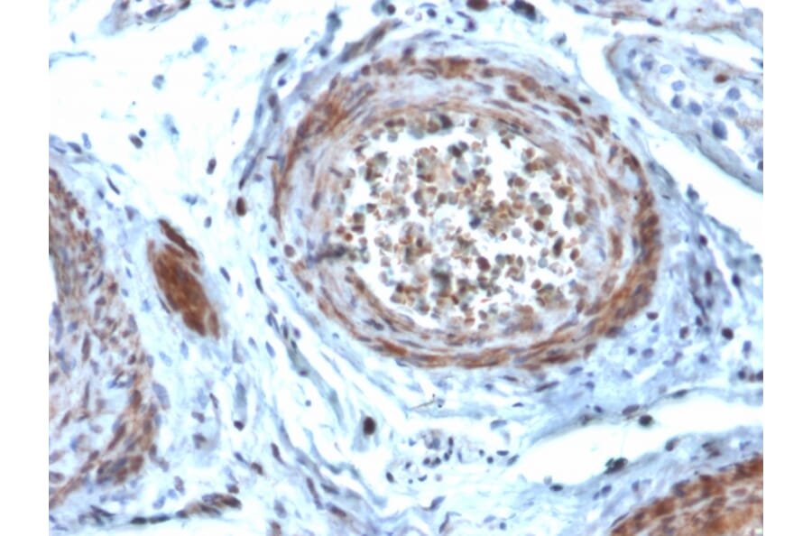 Immunohistochemistry - Anti-StAR Antibody [STAR/2077] (A250058) - Antibodies.com