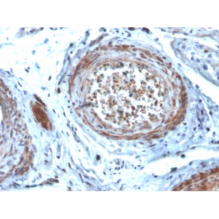 Immunohistochemistry - Anti-StAR Antibody [STAR/2077] (A250058) - Antibodies.com
