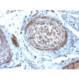 Immunohistochemistry - Anti-StAR Antibody [STAR/2077] (A250058) - Antibodies.com