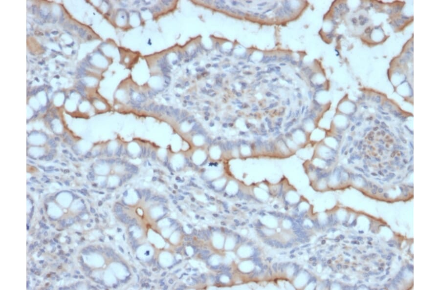 Immunohistochemistry - Anti-StAR Antibody [STAR/2077] (A250057) - Antibodies.com