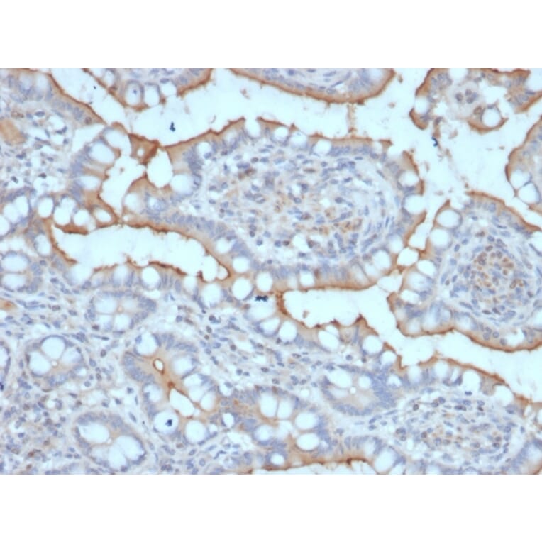 Immunohistochemistry - Anti-StAR Antibody [STAR/2077] (A250057) - Antibodies.com