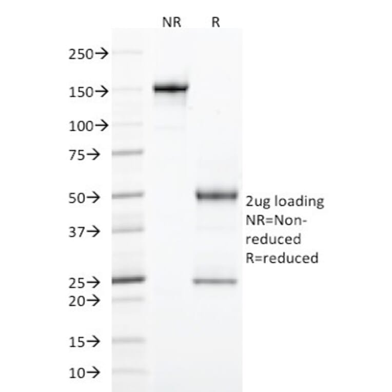 SDS-PAGE - Anti-StAR Antibody [STAR/2077] (A250058) - Antibodies.com