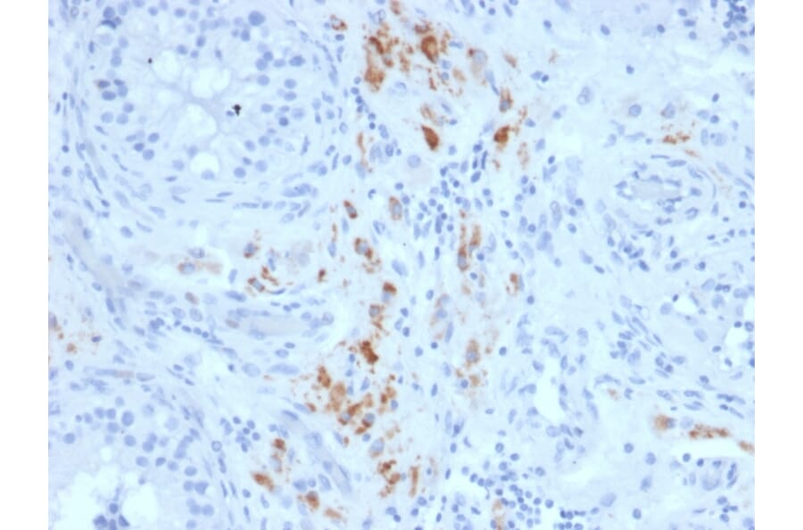 Immunohistochemistry - Anti-StAR Antibody [STAR/2140] (A250059) - Antibodies.com