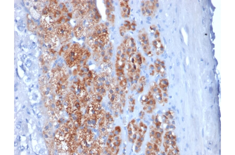 Immunohistochemistry - Anti-StAR Antibody [STAR/2154] (A250060) - Antibodies.com