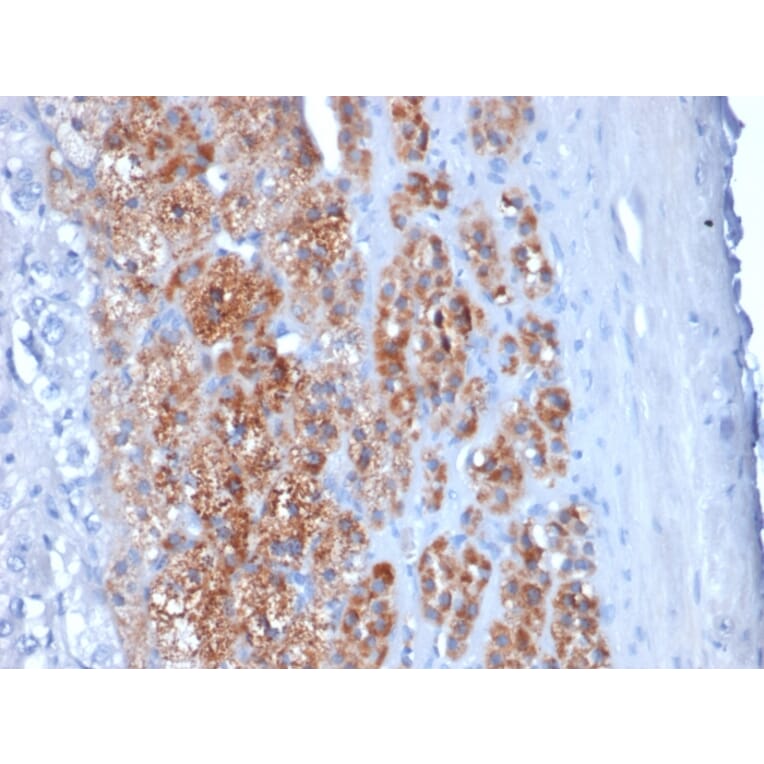 Immunohistochemistry - Anti-StAR Antibody [STAR/2154] (A250060) - Antibodies.com