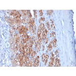 Immunohistochemistry - Anti-StAR Antibody [STAR/2154] (A250060) - Antibodies.com