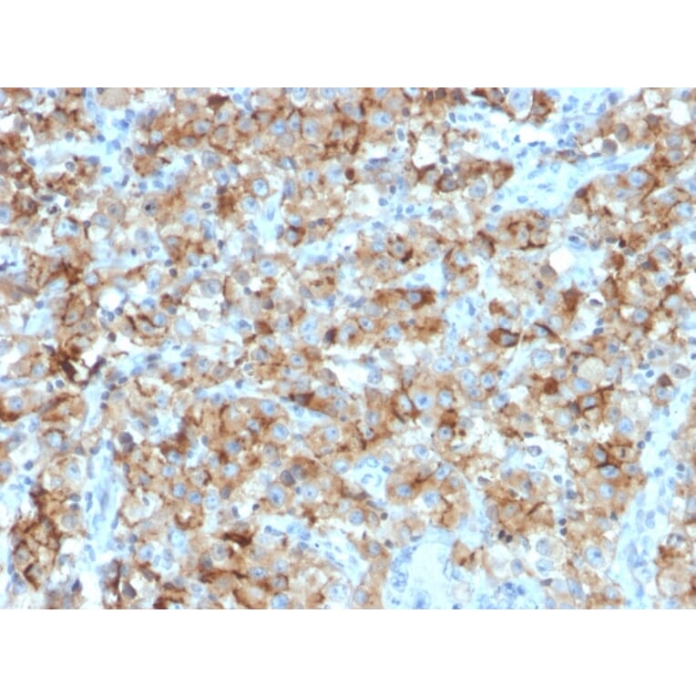 Immunohistochemistry - Anti-StAR Antibody [STAR/2154] (A250060) - Antibodies.com