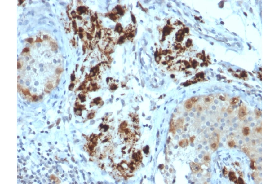 Immunohistochemistry - Anti-StAR Antibody [STAR/2154] (A250060) - Antibodies.com
