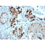 Immunohistochemistry - Anti-StAR Antibody [STAR/2154] (A250060) - Antibodies.com