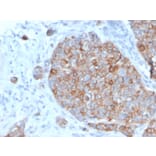 Immunohistochemistry - Anti-STAT2 Antibody [STAT2/2650] (A250061) - Antibodies.com