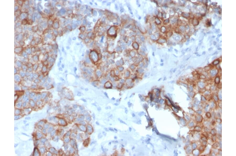 Immunohistochemistry - Anti-STAT2 Antibody [STAT2/2650] (A250060) - Antibodies.com