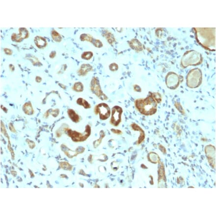 Immunohistochemistry - Anti-STAT3 Antibody [STAT3/2409] (A250062) - Antibodies.com