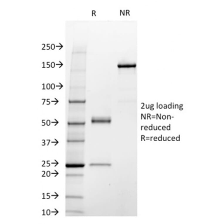 SDS-PAGE - Anti-STAT3 Antibody [STAT3/2409] (A250062) - Antibodies.com