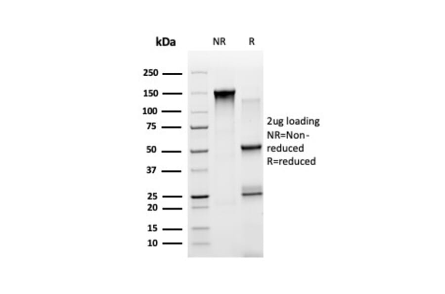 SDS-PAGE - Anti-STAT5A Antibody [PCRP-STAT5A-1A11] (A250063) - Antibodies.com