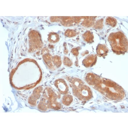 Immunohistochemistry - Anti-STAT5B Antibody [STAT5B/2611] (A250065) - Antibodies.com