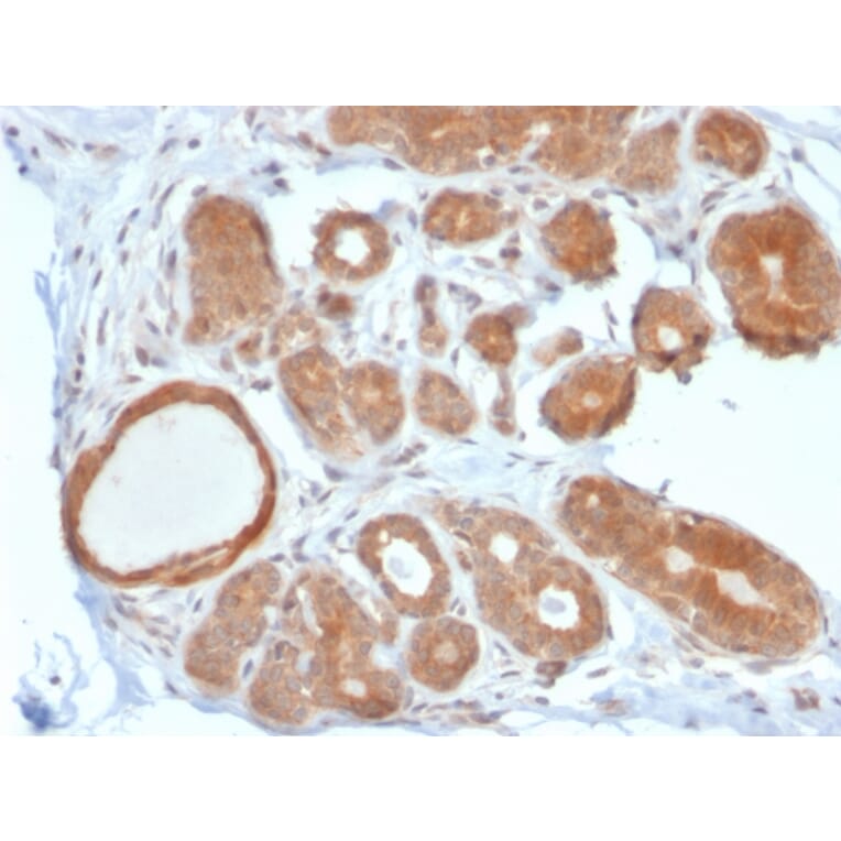 Immunohistochemistry - Anti-STAT5B Antibody [STAT5B/2611] (A250065) - Antibodies.com