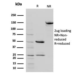 SDS-PAGE - Anti-STAT5B Antibody [STAT5B/2657] (A250066) - Antibodies.com