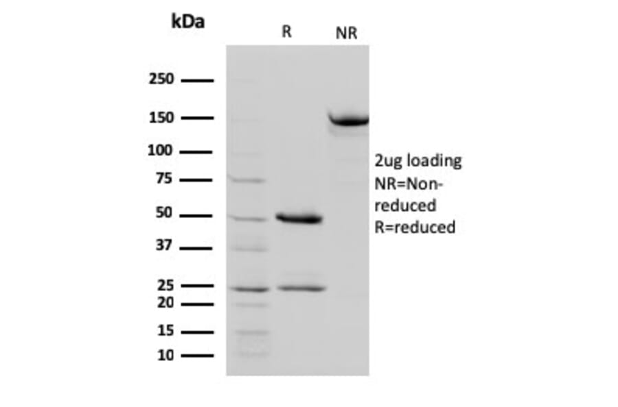 SDS-PAGE - Anti-STAT5B Antibody [STAT5B/2657] (A250066) - Antibodies.com