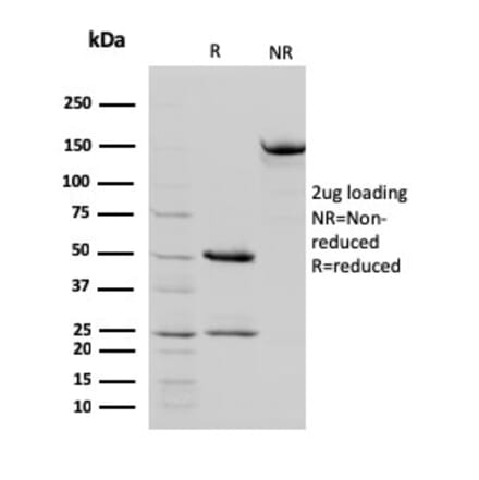 SDS-PAGE - Anti-STAT5B Antibody [STAT5B/2657] (A250066) - Antibodies.com