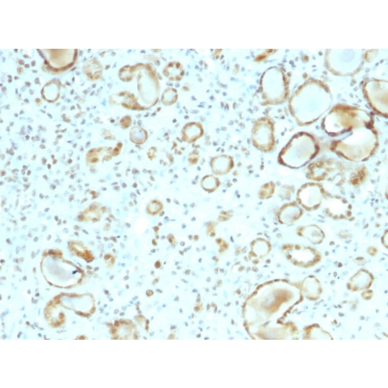 Immunohistochemistry - Anti-STAT6 Antibody [STAT6/2410] (A250067) - Antibodies.com