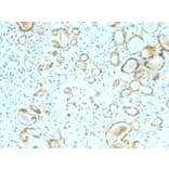 Immunohistochemistry - Anti-STAT6 Antibody [STAT6/2410] (A250067) - Antibodies.com